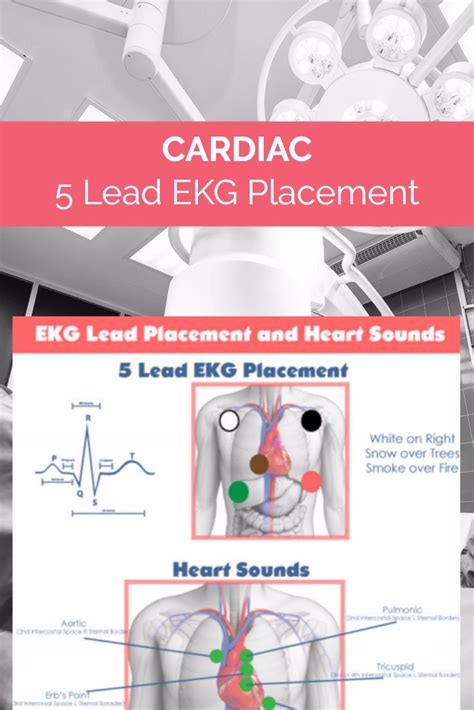 Free Nursing Cheatsheets Download Now Ekg Placement