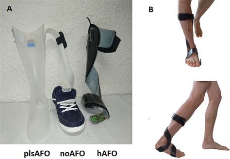 A Images Of The Posterior Ankle Foot Orthosis Plsafo Shoe Worn By