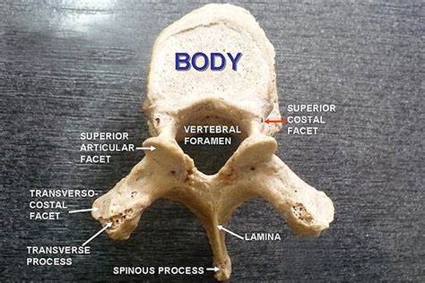 Vertebrae Different Types Cervical Thoracic Lumbar Sacrococcygeal