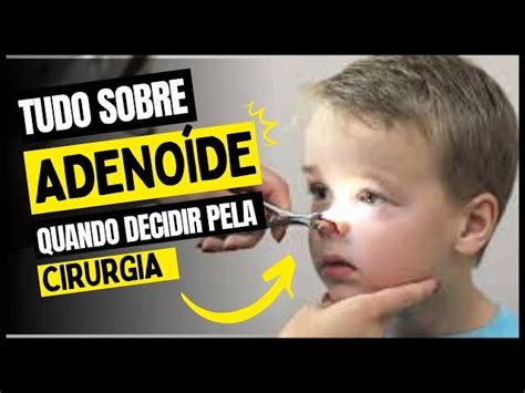 Como é a cirurgia de adenoide a carne esponjosa em criança Dr Paulo