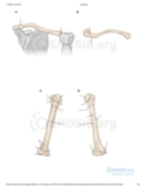 Solution Bones Of The Upper Limb Osmosis Prime Studypool