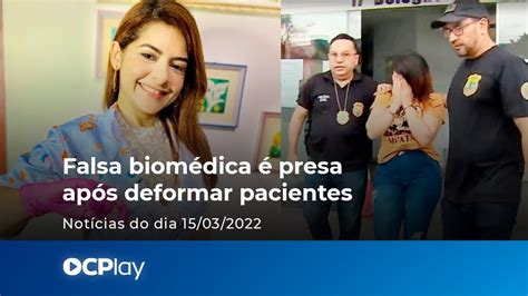 Falsa Biom Dica Presa Ap S Deformar Pacientes Youtube