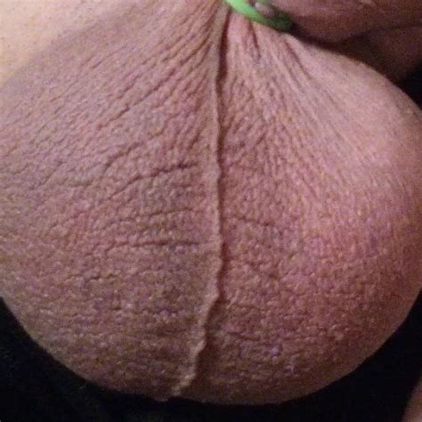 Complete Minutes Double Elastrator Castration Time Lapse Gay Amateur Amateur Porn XHamster