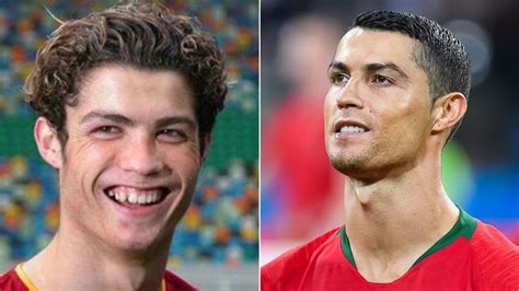 Cristiano Ronaldo Antes Y Después De La Cirugía Los Cambios De Apariencia Que Ha Tenido Cr7