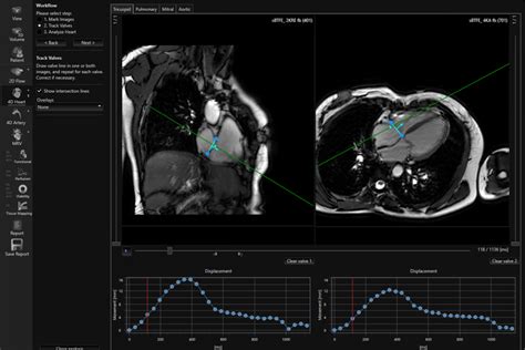 D Flow Pie Medical Imaging