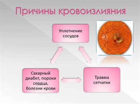 Презентация - Патология сетчатки » Привет Студент!