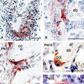 Syndecan Protein Distribution In Alveolar Bone Of Pn And Pn Mouse