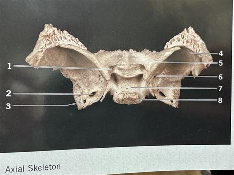 Sphenoid Bone Superior View Diagram Quizlet