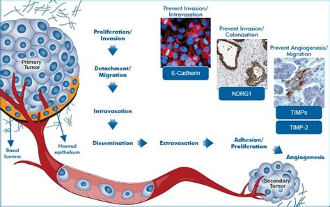 Metastasis: Novus Biologicals