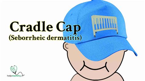 What Is Cradle Cap And What Can I Do Helpmommy