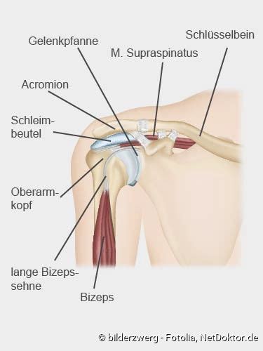 Schulterschmerzen Ursachen Diagnose Behandlung Tipps Netdoktor At