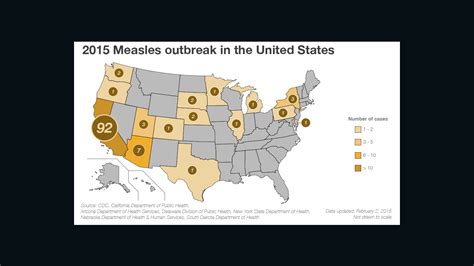 2015 Measles Outbreak What To Know Cnn