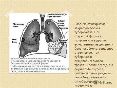 Презентация на тему: "Туберкулёз Различают открытую и закрытую формы ...