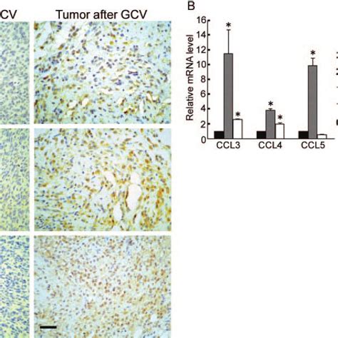 Accumulation Of Tumor Infiltrating Ccr1 Ccr5 Or Ccl3 Posi Tive