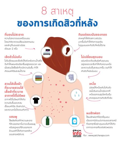 8 สาเหตุของการเกิดสิวที่หลัง