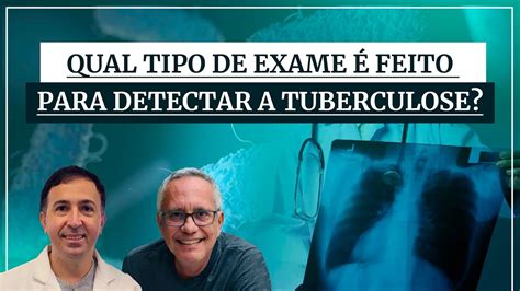 Descubra Como Detectar A Tuberculose Com Dr Gustavo Cabral