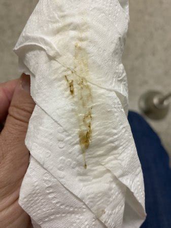 TWW Discharge Implantation TMI PIC WARNING BabyCenter