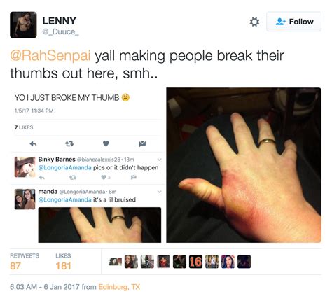 People Are Trying To Break Their Thumbs Because Of This Stupid Internet Picture Her Ie