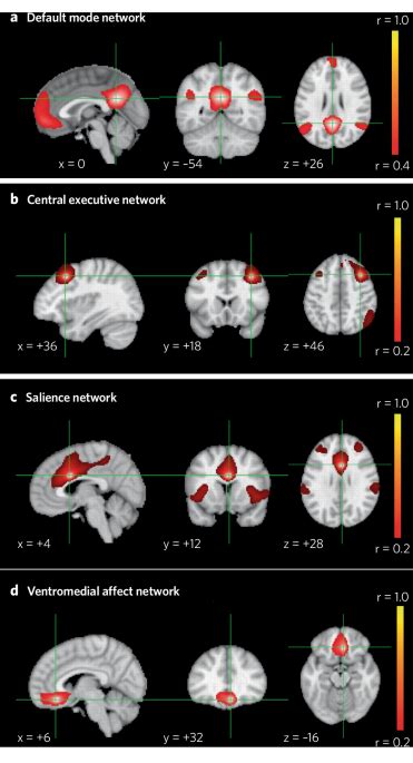 Breakthroughs And Challenges For Generating Brain Network Based