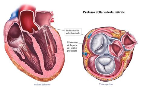 Soffio Al Cuore Sintomi Nei Bambini Neonati E In Gravidanza Cause