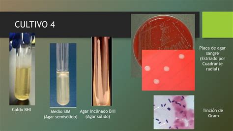 Tema Cultivo De Bacterias Bacteriolog A Pptx