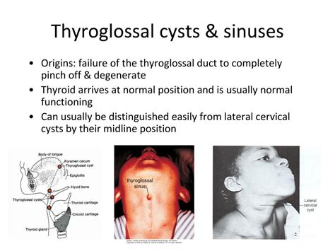 Ppt Craniofacial And Pharyngeal Arch Development Powerpoint