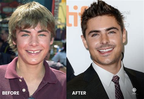 Le Parcours Du Sourire Hollywoodien De Zac Efron