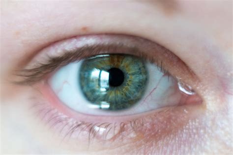 Alergia En Los Ojos Síntomas Y Tratamientos Ejercicio Para La Salud