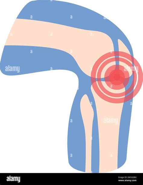 Knee Pain Icon Cartoon Vector Arthritis Joint Treatment Articulation