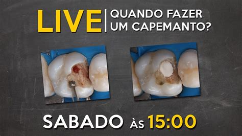 LIVE 031 Quando Fazer Um Capeamento YouTube