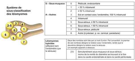 Prise En Charge Des Léiomyomes Utérins Journal Of Obstetrics And