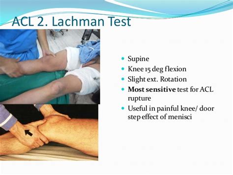 Meniscus Test Sensitivity Montreallasopa