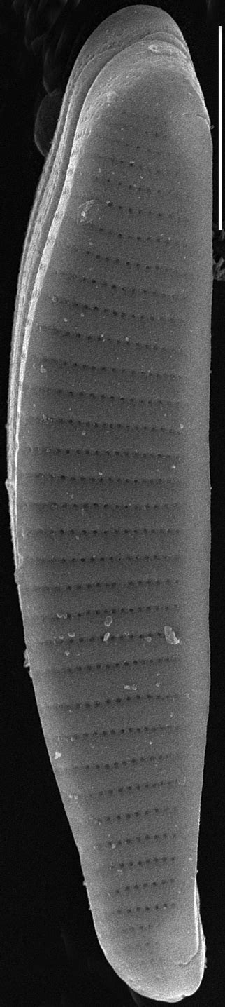 Image E Papilioforma SEM 6 18 05 4 Outer 5um Species Diatoms Of