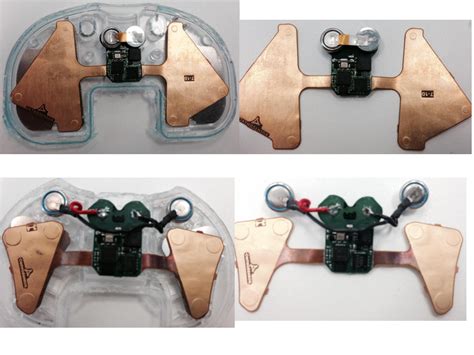 Orthosnsr5 Smith And Nephew Verasense Knee System Teardown Internal