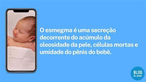 Esmegma O Que E Como Tratar E Prevenir Blog Da Sa De