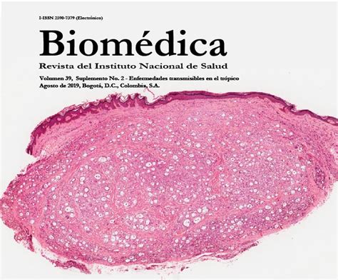 Leishmaniasis Mucosa Una Enfermedad Olvidada Descripción E