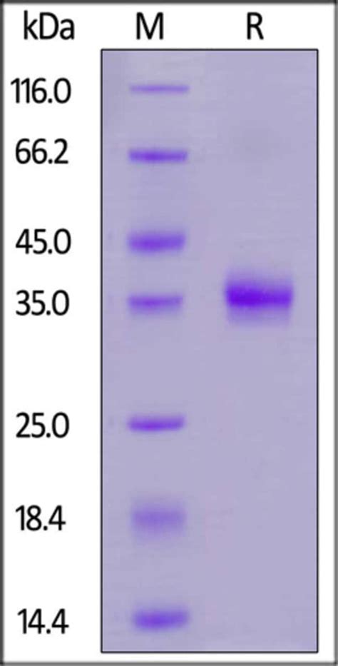 Acrobiosystems Acrobiosystems Biotinylated Sars Cov Spike Rbd K N