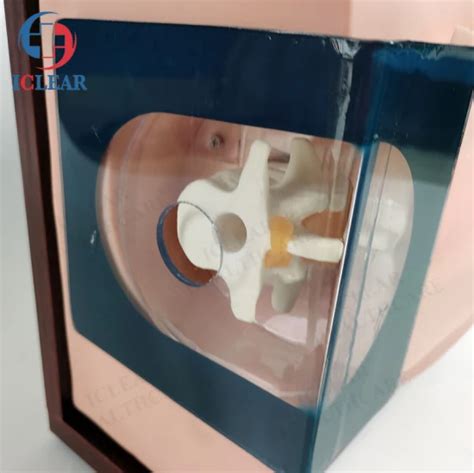 Medical Model Epidural Anesthesia Lumbar Puncture Training Simulator