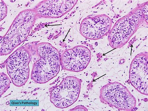 Sertoli Cells Histology