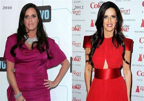 Patti Stanger Plastic Surgery Before And After Photos - CelebLens.Com