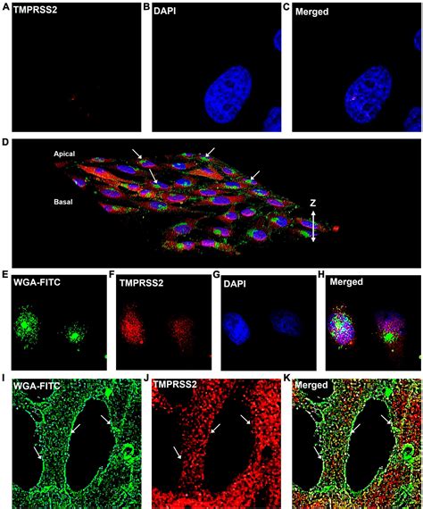 Frontiers Endocytosis Inhibitors Block Sars Cov 2 Pseudoparticle