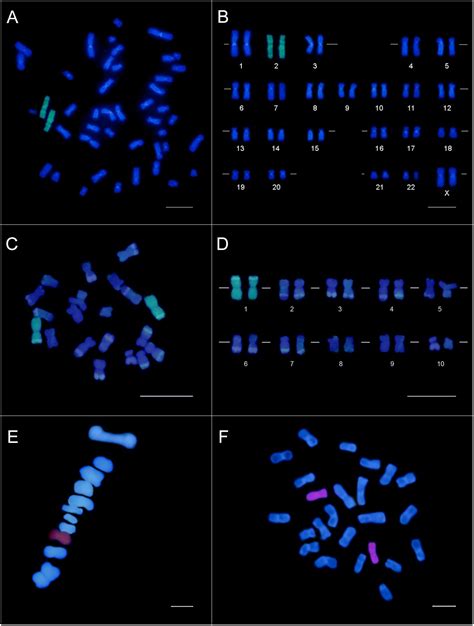 Chromosomes In A Plant Cell