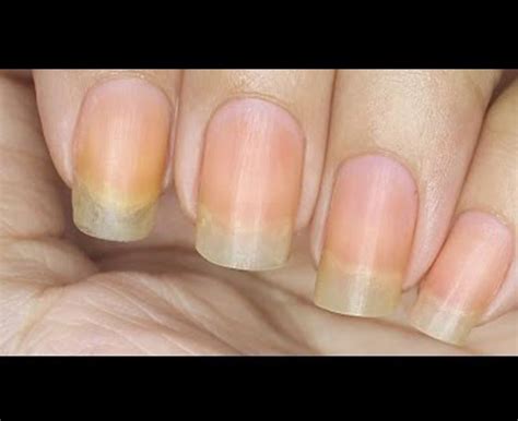 3 Reasons Your Nails Are Yellow And How You Can Whiten Them - Sunday