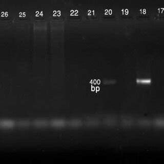 A And B Ethidium Bromide Stained Agarose Gel Of Pcr Amplified