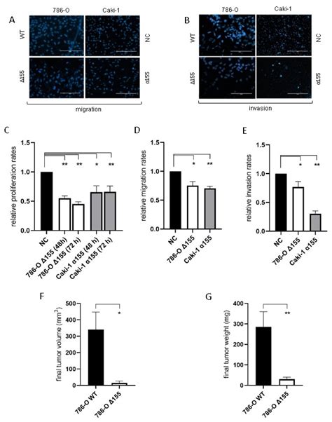 Microrna 155 5p Targets Jade 1 Promoting Proliferation Migration And Invasion In Clear Cell