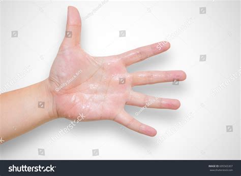 sweating hands images stock  vectors shutterstock