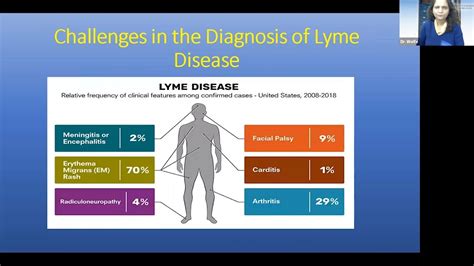 Early Signs And Symptoms Of Lyme Disease Youtube