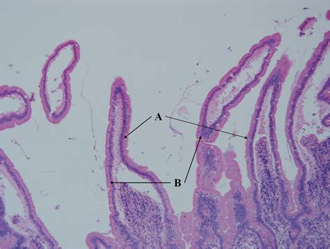 Goblet Cell Pancreas And Liver