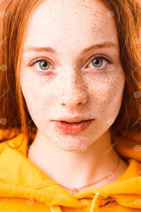 Portrait Of An Emotional Red Haired Girl With Freckles And Braces On A