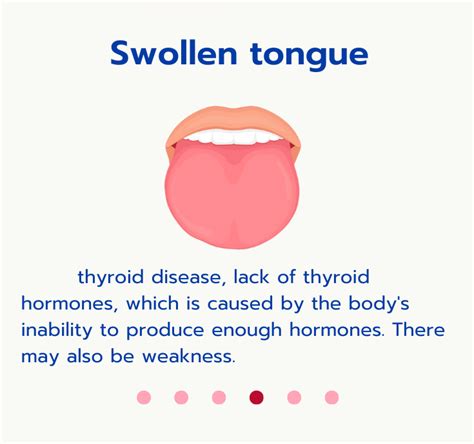 Did You Know Tongue Can Tell Disease Chiangmai Hospital Tel 053